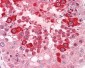CLEC7A / Dectin 1 Antibody (Internal)